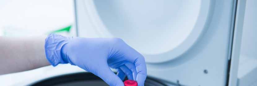 超高分子量聚乙烯(PE-UHMW)板材檢測