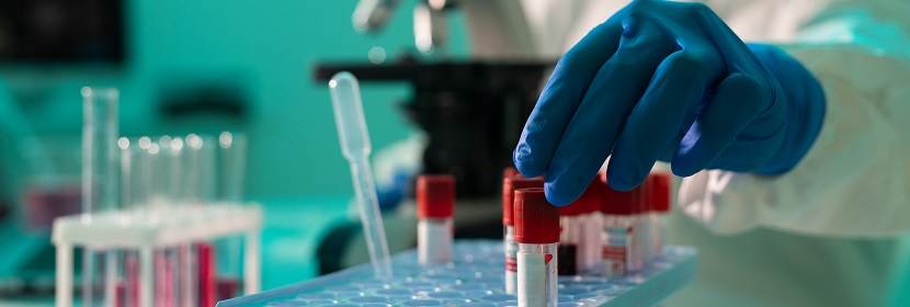 氯烴基硅烷偶聯劑檢測